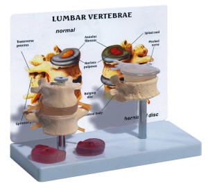 lumbale wervelzuil