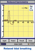 spirometrie