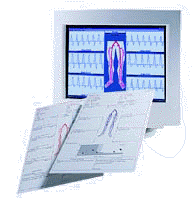 Dopplex Reporter Software DR3