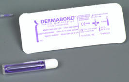 dermabond