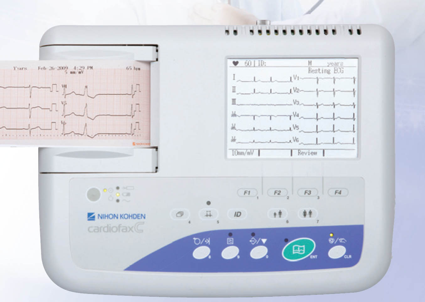 ekg