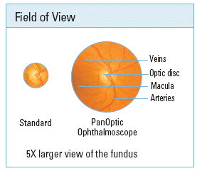 panoptic