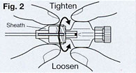 epidurale 