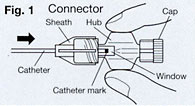 epidurale naalden